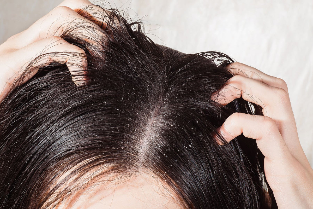 From Dry Scalp to Breakage: How Hard Water Quietly Blocks Every Product You Use