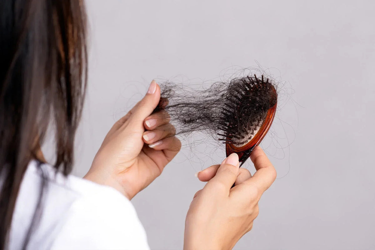 Postpartum hair shedding, illustrating telogen effluvium overlapping with hard water