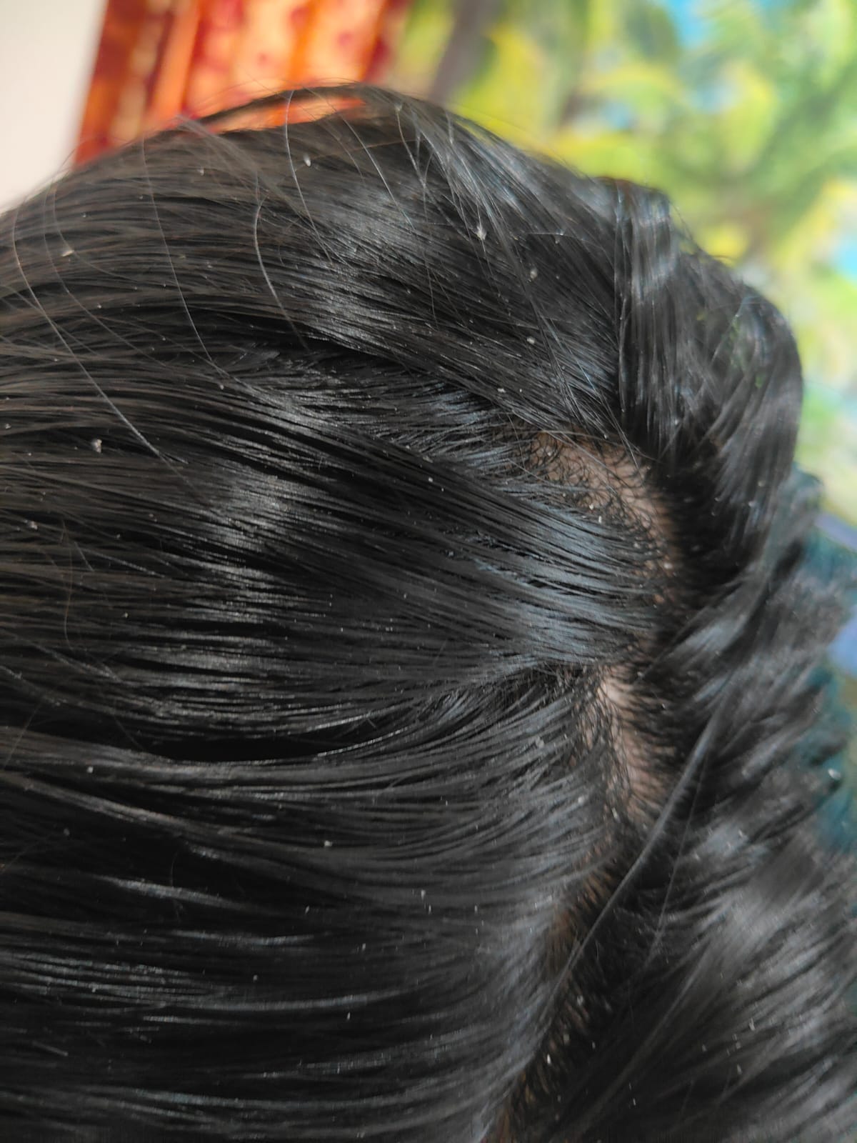 Scalp before using deSal